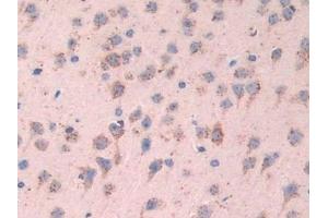 Immunohistochemistry (IHC) image for anti-Tripeptidyl Peptidase I (TPP1) (AA 198-562) antibody (ABIN7440935)