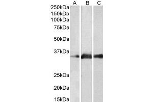 ABIN2563589 (2µg/ml) staining of Human Brain (Cerebellum) (A), Mouse Brain (B) and Rat Brain (C) lysates (35µg protein in RIPA buffer). (Kallikrein 5 抗体  (Internal Region))