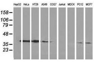 Image no. 5 for anti-Annexin A3 (ANXA3) antibody (ABIN1496642) (Annexin A3 抗体)