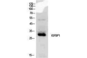 Western Blotting (WB) image for anti-Insulin-Like Growth Factor Binding Protein 1 (IGFBPI) (Internal Region) antibody (ABIN3188011) (IGFBPI 抗体  (Internal Region))