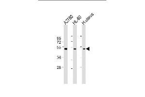 All lanes : Anti-B Antibody (Center) at 1:2000 dilution Lane 1:  whole cell lysate Lane 2: HL-60 whole cell lysate Lane 3: Human uterus lysate Lysates/proteins at 20 μg per lane. (BMP15 抗体  (AA 241-271))