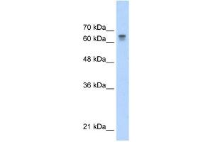 PARP6 antibody used at 0. (PARP6 抗体)