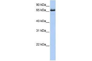 ZDHHC17 antibody used at 1 ug/ml to detect target protein. (ZDHHC17 抗体  (Middle Region))