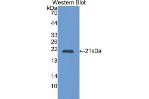 Detection of Recombinant CTSL, Rat using Polyclonal Antibody to Cathepsin L (CTSL) (Cathepsin L 抗体  (AA 114-288))