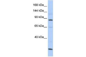 MSH5 antibody used at 1 ug/ml to detect target protein.