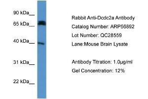 WB Suggested Anti-Dcdc2a  Antibody Titration: 0. (DCDC2 抗体  (N-Term))
