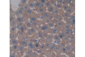 Used in DAB staining on fromalin fixed paraffin- embedded liver tissue (ABCG5 抗体  (AA 66-276))