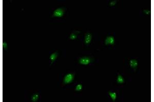 Immunofluorescence staining of U251 cells with ABIN7145872 at 1:250, counter-stained with DAPI. (BUD13 抗体  (AA 132-233))