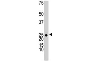 The KHK polyclonal antibody  is used in Western blot to detect KHK in 293 cell lysate . (Ketohexokinase 抗体  (N-Term))