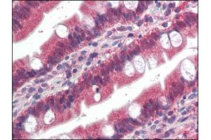 Human Small Intestine (formalin-fixed, paraffin-embedded) stained with FGFR1at 4 µg/ml followed by biotinylated anti-goat IgG secondary antibody, alkaline phosphatase-streptavidin and chromogen. (FGFR1 抗体  (C-Term))