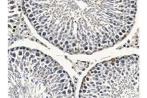 FOXO4 Mouse Monoclonal Antibody at 1/100 staining rat testis tissue by IHC-P. (FOXO4 抗体  (Internal Region))