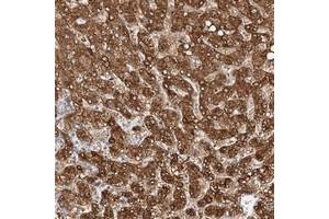 Immunohistochemical staining of human liver with NIT2 polyclonal antibody  shows strong cytoplasmic positivity in hepatocytes at 1:200-1:500 dilution. (NIT2 抗体)