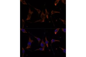 Immunofluorescence analysis of L929 cells using RPL7A Polyclonal Antibody (ABIN6128657, ABIN6147150, ABIN6147152 and ABIN6217809) at dilution of 1:100 (40x lens).