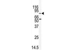 Western blot analysis of MARK2 antibody and mouse thymus tissue lysate (MARK2 抗体  (AA 600-630))