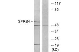 Western blot analysis of extracts from LOVO cells, using SFRS4 Antibody. (SRSF4 抗体  (AA 111-160))