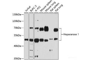 Western blot analysis of extracts of various cells using Heparanase 1 Polyclonal Antibody at dilution of 1:1000. (HPSE 抗体)