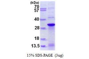 Image no. 1 for DnaJ (Hsp40) Homolog, Subfamily C, Member 12 (DNAJC12) (AA 1-198) protein (His tag) (ABIN1098343)