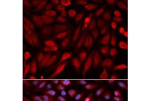 Immunofluorescence analysis of U2OS cells using SDCBP Polyclonal Antibody (SDCBP 抗体)