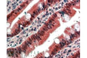 ABIN185351 (4µg/ml) staining of paraffin embedded Human Small Intestine. (FGFR1 抗体  (C-Term))