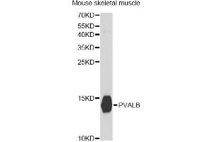 Western blot analysis of extracts of mouse skeletal muscle, using PVALB antibody (ABIN5971476) at 1:400 dilution. (PVALB 抗体)