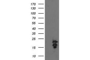 Western Blotting (WB) image for anti-Fibroblast Growth Factor 21 (FGF21) antibody (ABIN1498256) (FGF21 抗体)