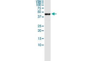 Immunoprecipitation of MVD transfected lysate using rabbit polyclonal anti-MVD and Protein A Magnetic Bead ( U0007 ), and immunoblotted with mouse purified polyclonal anti-MVD. (MVD (人) IP-WB Antibody Pair)