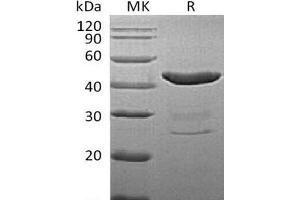 Western Blotting (WB) image for Indoleamine 2,3-Dioxygenase 1 (IDO1) protein (His tag) (ABIN7320560) (IDO1 Protein (His tag))