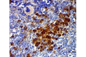 IHC testing of mouse spleen stained with CD63 antibody (MX49. (CD63 抗体)