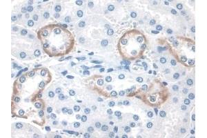 Immunohistochemistry (IHC) image for anti-Signal Transducing Adaptor Molecule (SH3 Domain and ITAM Motif) 2 (STAM2) (AA 1-377) antibody (ABIN7444229)