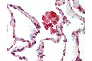 Anti-NDUFS8 antibody IHC staining of human lung. (NDUFS8 抗体  (C-Term))