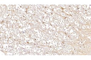 Detection of DUSP3 in Human Spinal cord Tissue using Monoclonal Antibody to Dual Specificity Phosphatase 3 (DUSP3) (Dual Specificity Phosphatase 3 (DUSP3) (AA 2-185) 抗体)