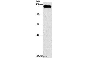 Western blot analysis of 231 cell, using CBL Polyclonal Antibody at dilution of 1:750 (CBL 抗体)