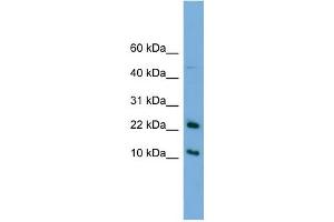 WB Suggested Anti-GM2A Antibody Titration:  0. (GM2A 抗体  (N-Term))