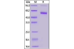 SDS-PAGE (SDS) image for CD7 (CD7) (AA 26-180) (Active) protein (lFc Tag,FITC) (ABIN6973017)