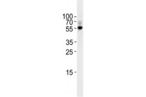 TGF Beta 2 antibody western blot analysis in Raji lysate. (TGFB2 抗体  (AA 277-306))