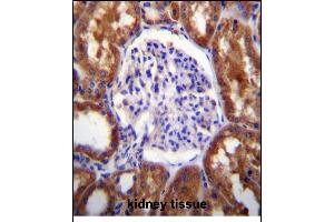 Immunohistochemistry (Paraffin-embedded Sections) (IHC (p)) image for anti-Solute Carrier Family 12 (Potassium-Chloride Transporter) Member 6 (SLC12A6) (AA 13-42), (N-Term) antibody (ABIN656316)