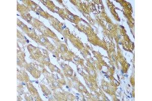 Immunohistochemistry of paraffin-embedded Human liver using IGF2BP3 Polyclonal Antibody at dilution of 1:100 (40x lens). (IGF2BP3 抗体)
