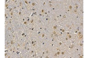 eEF2K Mouse Monoclonal Antibody at 1/100 staining rat brain tissue by IHC-P. (EEF2K 抗体  (Internal Region))