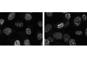 Immunofluorescent staining of HT1080 cells (ATCC CCL-121). (TP53BP1 抗体  (AA 149-259))