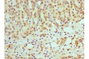Immunohistochemistry of paraffin-embedded human adrenal gland tissue using ABIN7145593 at dilution of 1:100 (SULT2A1 抗体  (AA 1-145))