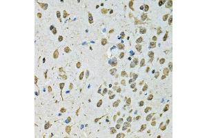 Immunohistochemistry (Paraffin-embedded Sections) (IHC (p)) image for anti-Proteasome (Prosome, Macropain) Subunit, beta Type, 1 (PSMB1) (AA 29-241) antibody (ABIN6146309)