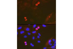 Immunofluorescence analysis of U-2 OS cells using T Rabbit mAb (ABIN7270916) at dilution of 1:100 (40x lens). (TACC3 抗体)