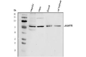 Western blot analysis of AMFR using anti-AMFR antibody (ABIN4886455).