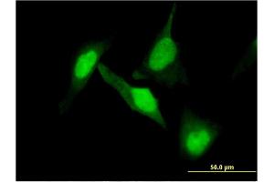 Immunofluorescence of monoclonal antibody to DPYSL2 on HeLa cell.