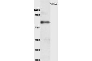 Rat lung lysates probed with Anti-phospho-IRAK4 (Thr345) Polyclonal Antibody (ABIN753538) at 1:200 in 4 °C. (IRAK4 抗体  (pThr345))