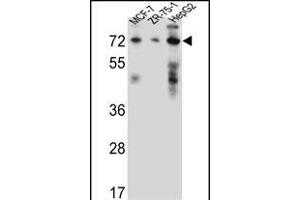 HSD17B4 Antibody (Center) (ABIN656447 and ABIN2845732) western blot analysis in MCF-7,ZR-75-1,HepG2 cell line lysates (35 μg/lane). (HSD17B4 抗体  (AA 341-370))