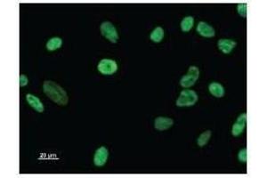 Immunostaining analysis in HeLa cells. (DDX17 抗体)