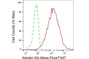 anti-Keratin 6A (KRT6A) antibody
