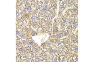 Immunohistochemistry of paraffin-embedded mouse liver using CYP2C18 antibody. (CYP2C18 抗体  (AA 231-490))
