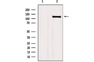 Western blot analysis of extracts from HUVEC, using FGFR1 Antibody. (FGFR1 抗体  (C-Term))